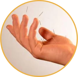 Kako akupunktura Su Jok radi?